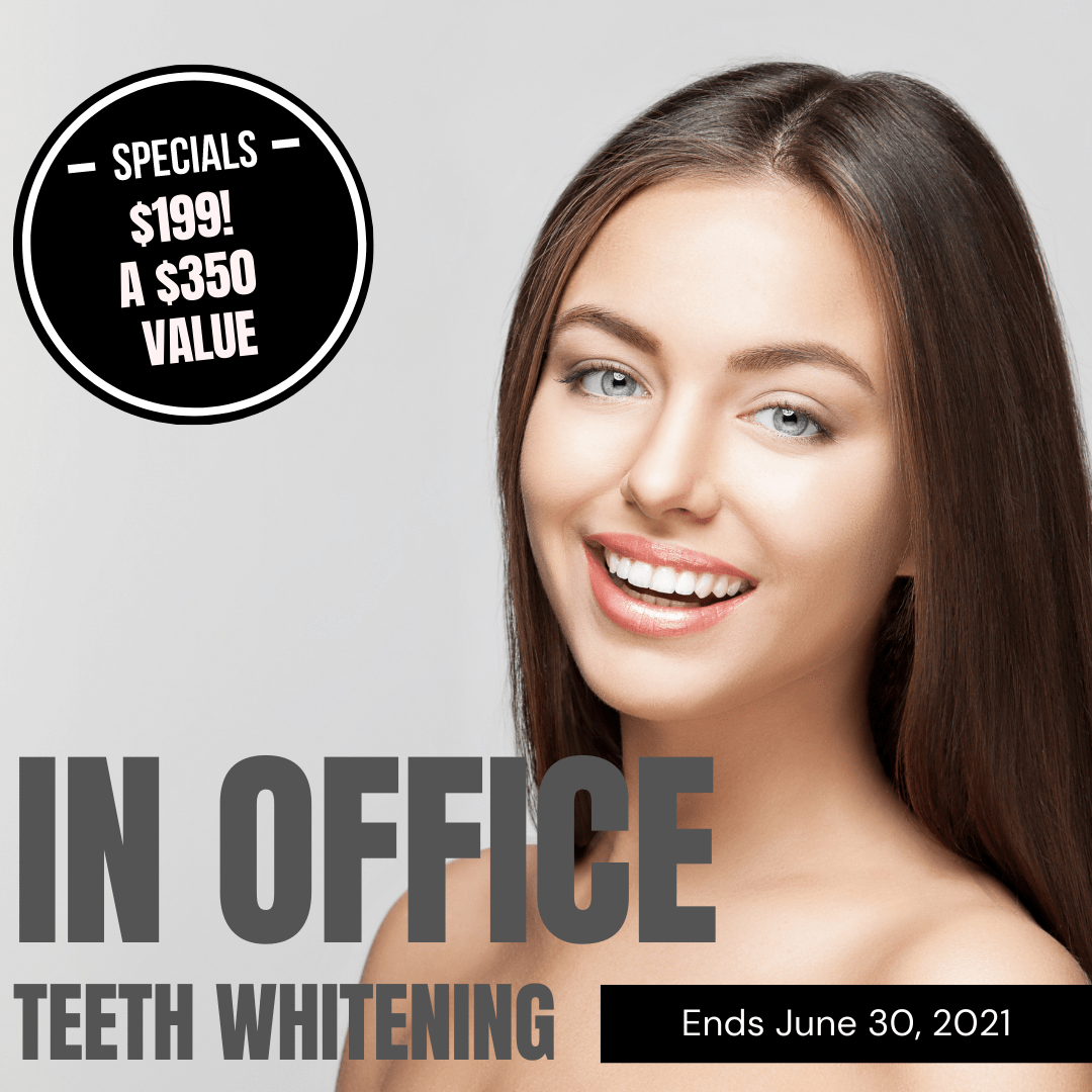 In-Office Teeth Whitening