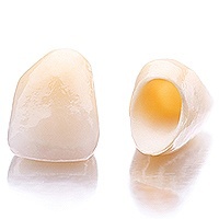 dental crowns and bridges