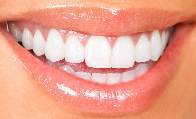 Teeth Whitening